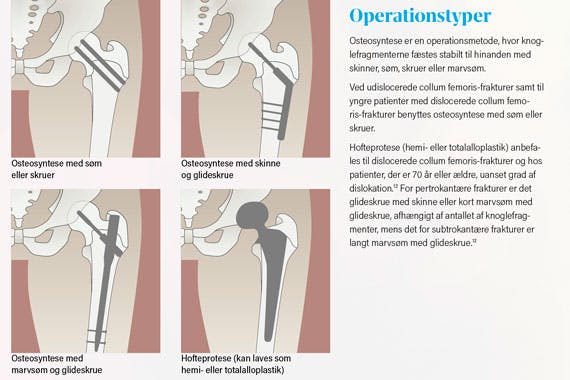 Fysioterapeuten-2024-06-operation-570px.jpg